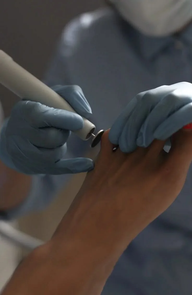 Professional diabetic foot care treatment performed by a podiatrist during a routine foot health appointment.